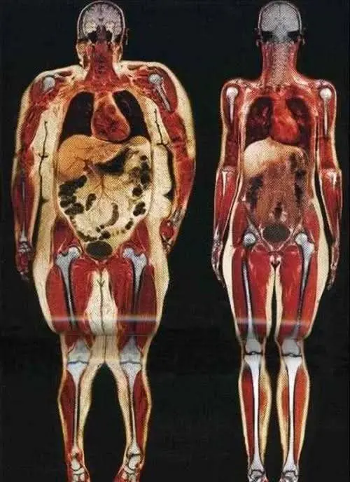 Body Cross-section Comparison Illustration
