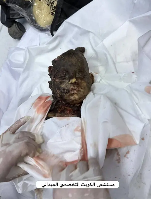 Burned Child, Medical Setting