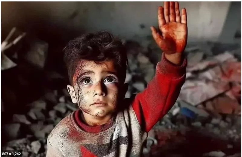 Child Raised Bloody Hand