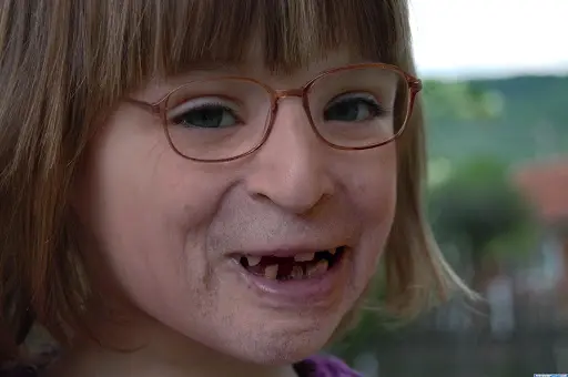 Child With Adult Face