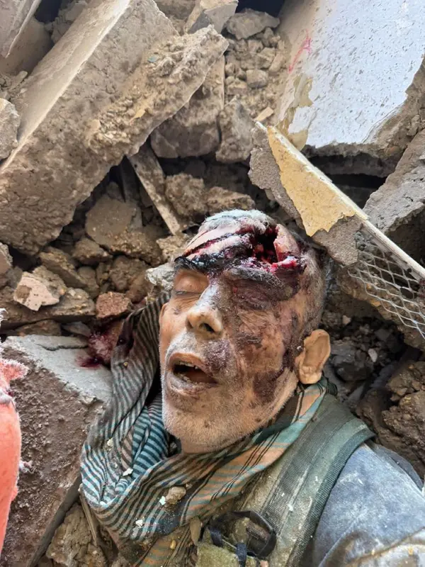 Injured Person In Rubble