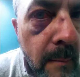 Man With Facial Injury