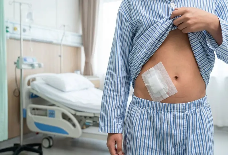 Post-Procedure Abdominal Dressing View