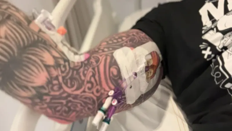 Tattooed Arm With IV